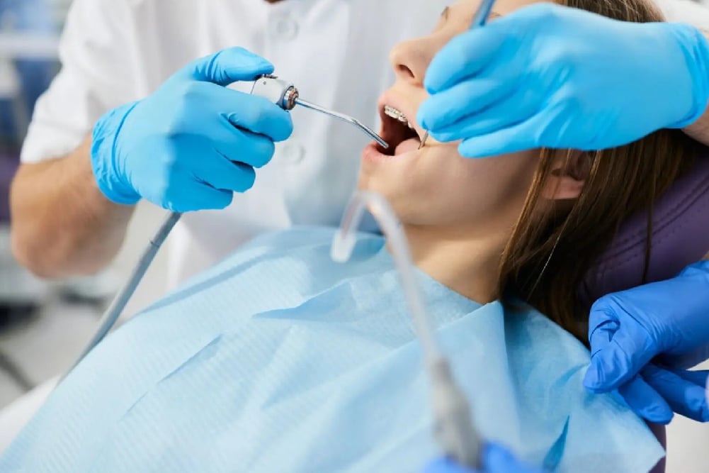 paciente en el dentista con la boca abierta